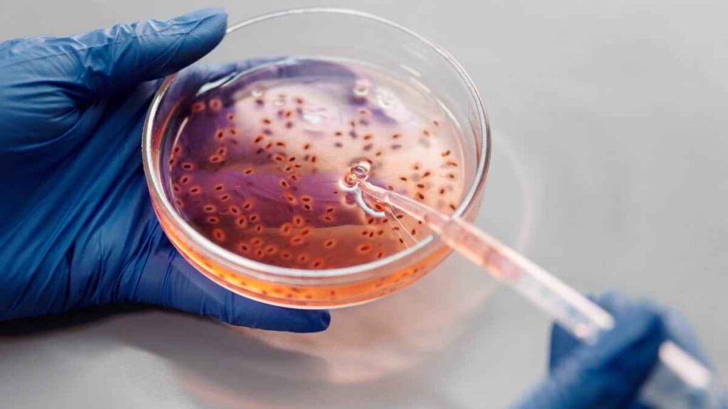 Como melhorar a saúde através da microbiota intestinal